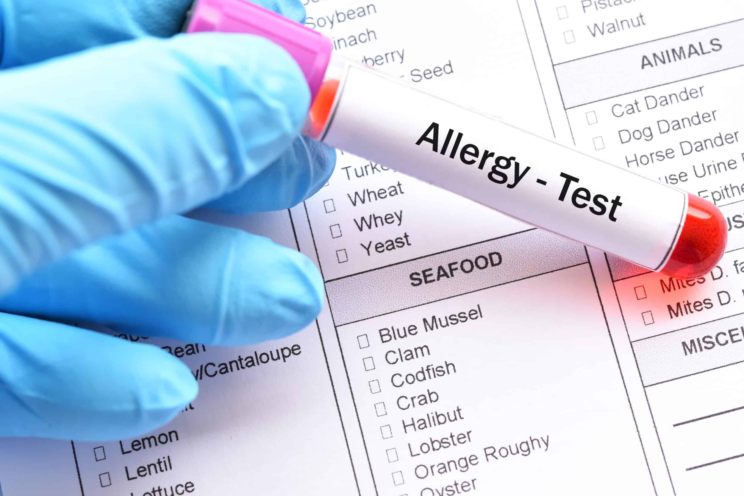 Allergy Testing in Norwich, CT